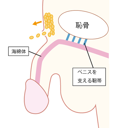 下腹部脂肪吸引長茎術1