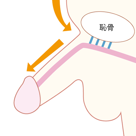 下腹部脂肪吸引長茎術2